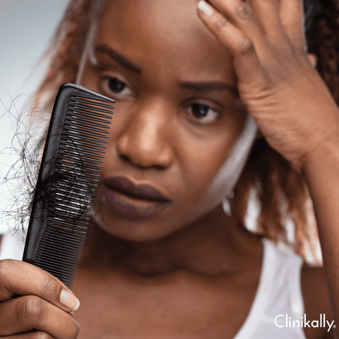 Unique challenges for women with Alopecia Areata