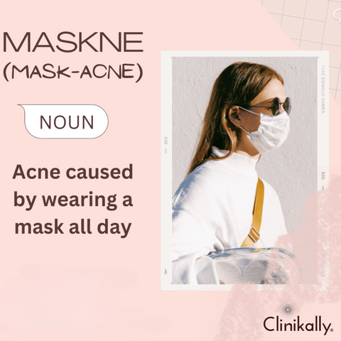 Face masks can really cause acne!