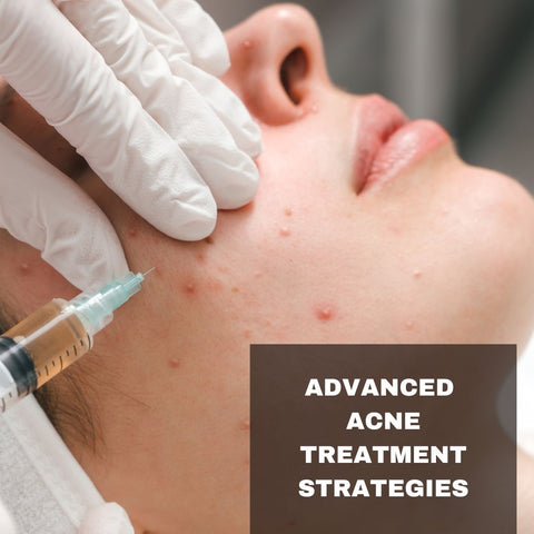 Advanced Acne Treatment Strategies