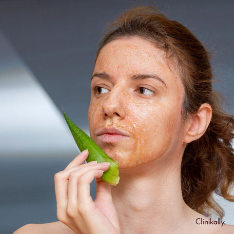 Aloe Vera for acne treatment and skin brightening
