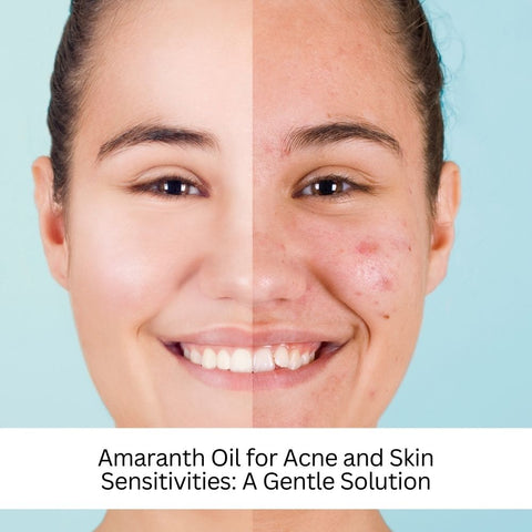 Amaranth Oil for Acne and Skin Sensitivities: A Gentle Solution