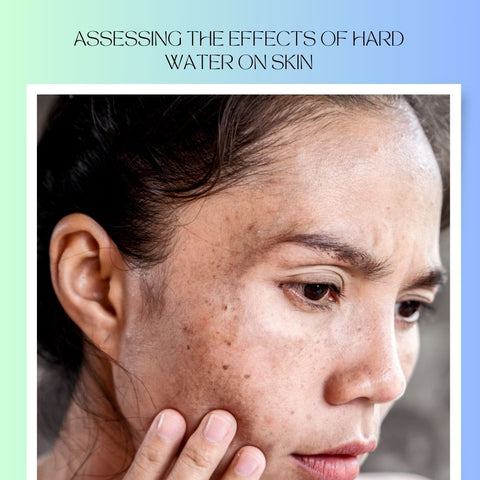 Assessing the Effects of Hard Water on Skin