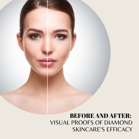 Before and After: Visual Proofs of Diamond Skincare's Efficacy