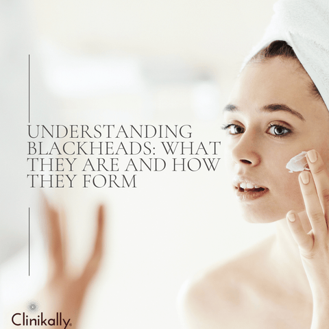 Understanding Blackheads: What They Are and How They Form