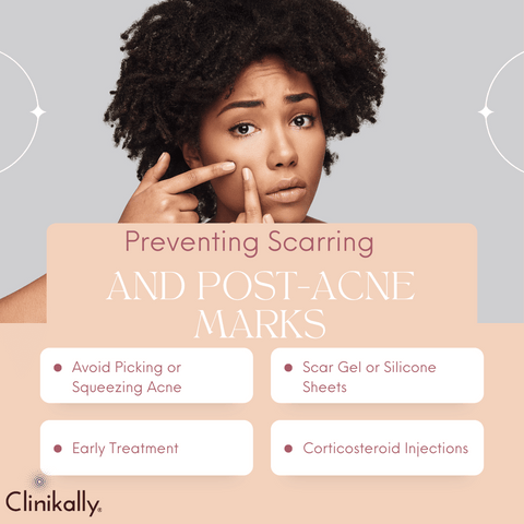 Preventing Scarring and Post-Acne Marks