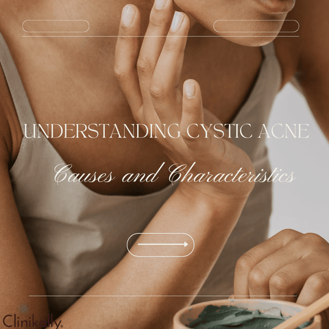 Understanding Cystic Acne: Causes and Characteristics
