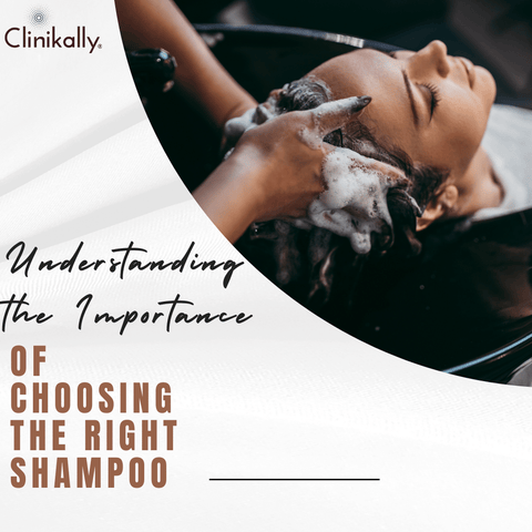 Understanding the Importance of Choosing the Right Shampoo