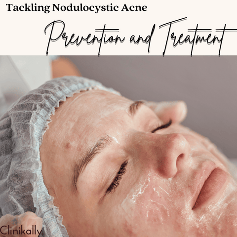 Tackling Nodulocystic Acne: Prevention and Treatment