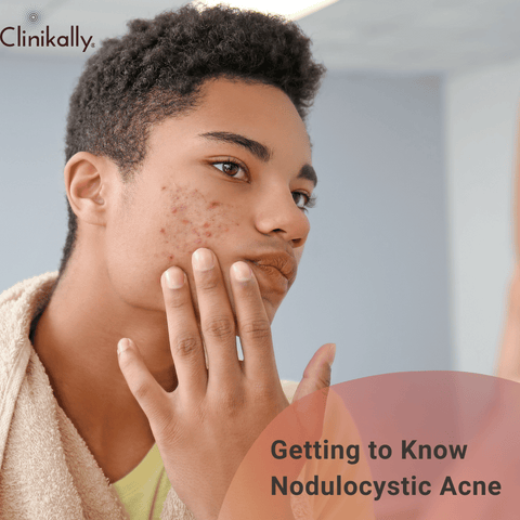 Getting to Know Nodulocystic Acne