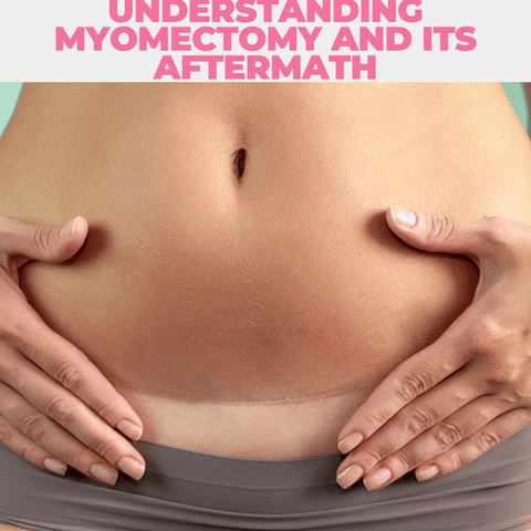 Understanding Myomectomy and Its Aftermath