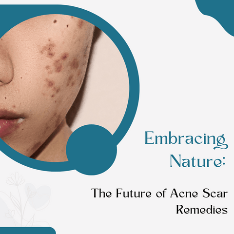 Embracing Nature: The Future of Acne Scar Remedies