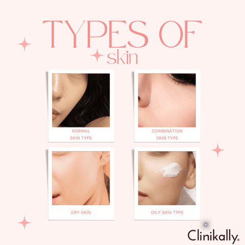 Understanding Your Skin Type