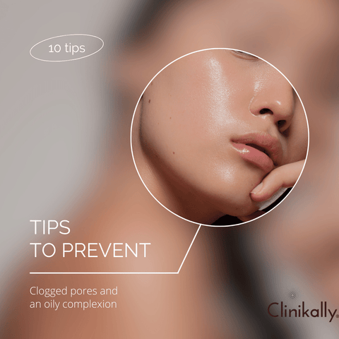 Tips to Prevent