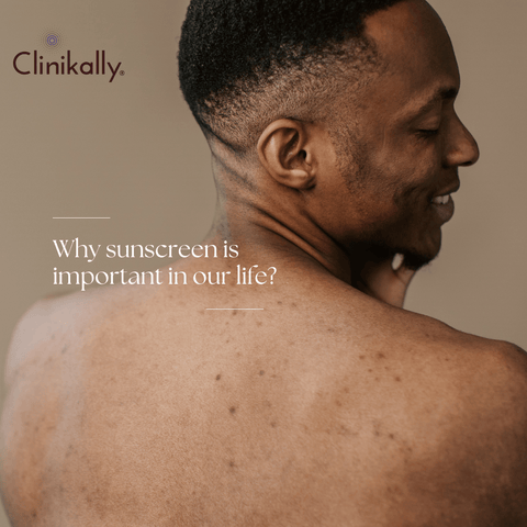 Sun Protection for Men: Emphasizing Importance, Clinikally