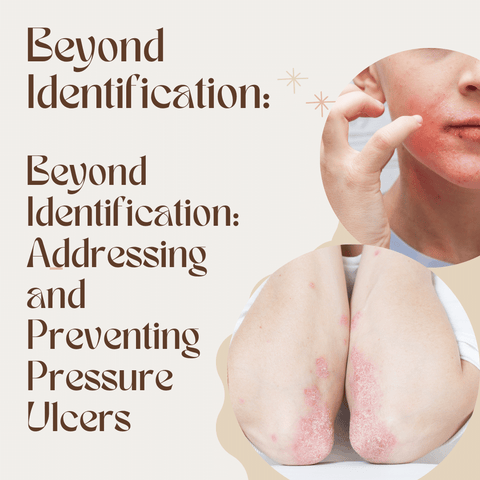 Beyond Identification: Addressing and Preventing Pressure Ulcers