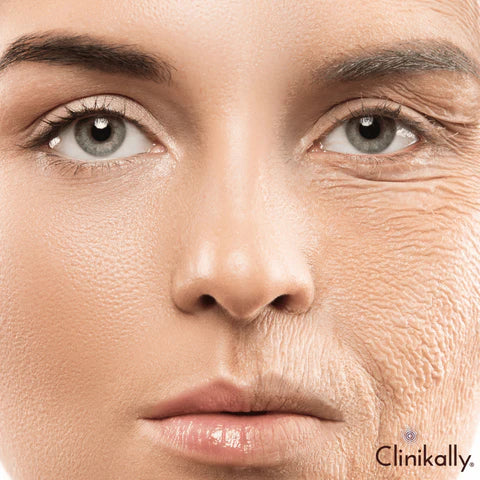 Premature aging or uneven skin tone