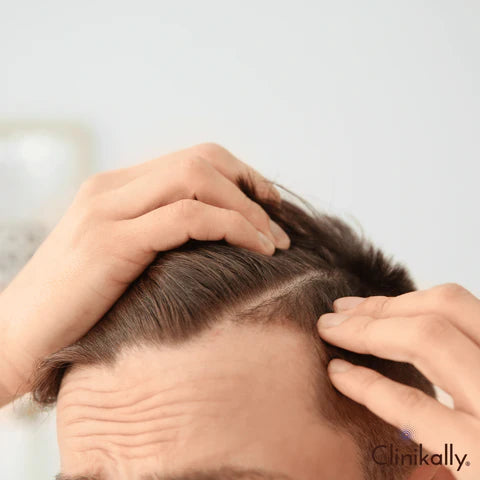 Causes of hair fall in teenage males