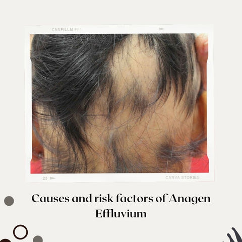 Causes and risk factors of Anagen Effluvium