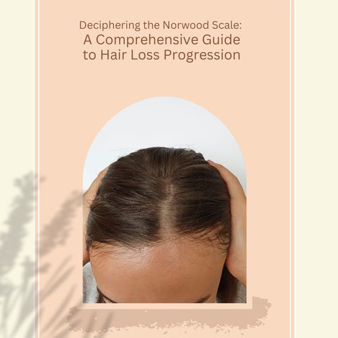 Deciphering the Norwood Scale: A Comprehensive Guide to Hair Loss Progression