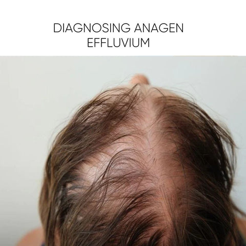 Diagnosing Anagen Effluvium