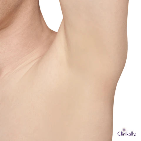 Understanding hormonal influences on underarm skin