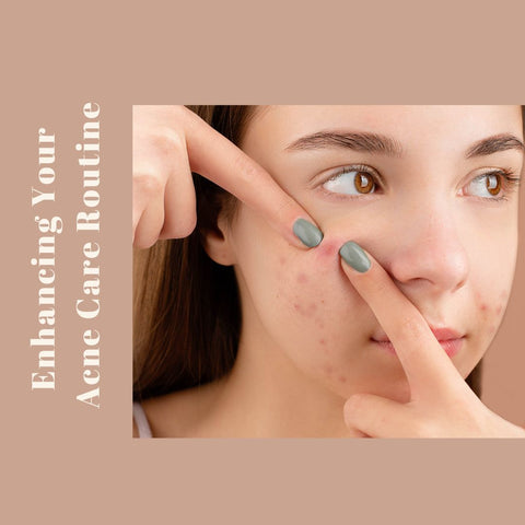 Enhancing Your Acne Care Routine