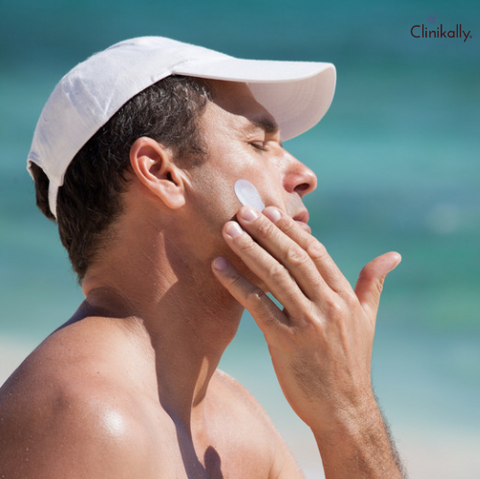 The Ultimate Guide to Treating and Preventing Sunburns