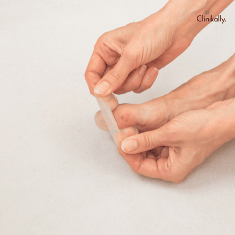 What is a Callus?