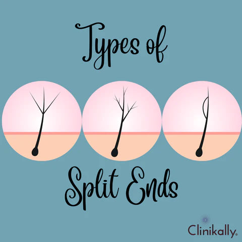 What are the types of split ends?