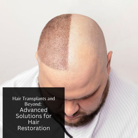 Hair Transplants and Beyond: Advanced Solutions for Hair Restoration