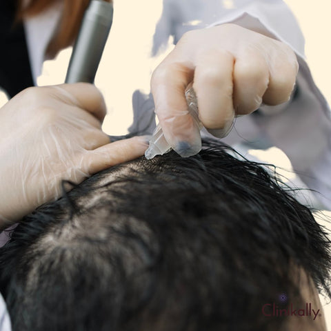 How Finasteride Works: Insights into Its Mechanism for Hair Regrowth