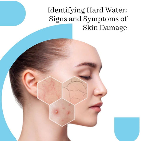 Identifying Hard Water: Signs and Symptoms of Skin Damage