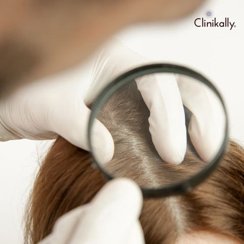 Breaking Down the Gender Differences in Hair Loss: What You Need to Know