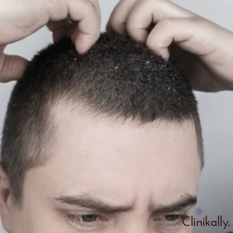 Identifying itchy scalp triggers