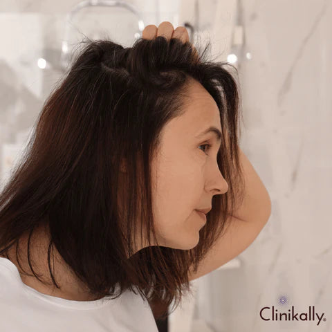 User experiences: Redensyl vs. Minoxidil