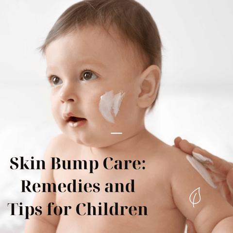 Skin Bump Care: Remedies and Tips for Children