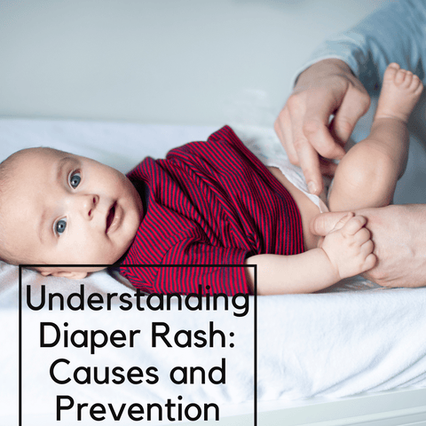 Understanding Diaper Rash: Causes and Prevention