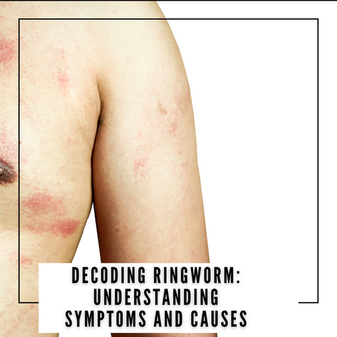 Ringworm Vs Eczema: What Is the Difference?