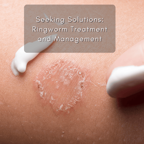 Seeking Solutions: Ringworm Treatment and Management