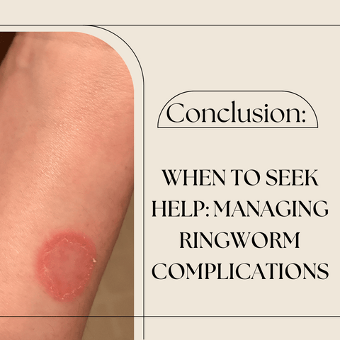When to Seek Help: Managing Ringworm Complications