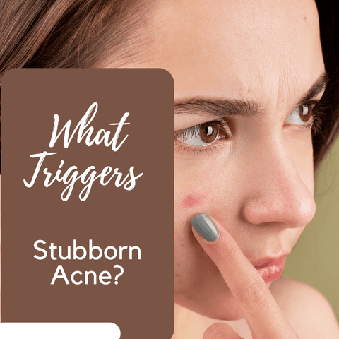 What Triggers Stubborn Acne?
