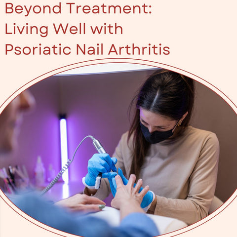 Beyond Treatment: Living Well with Psoriatic Nail Arthritis