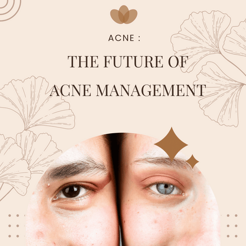 The Future of Acne Management