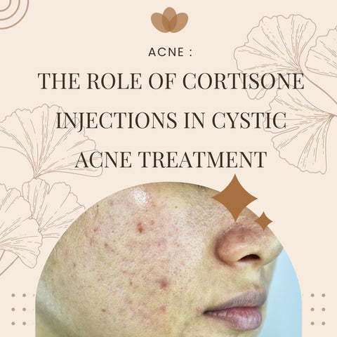 The Role of Cortisone Injections in Cystic Acne Treatment