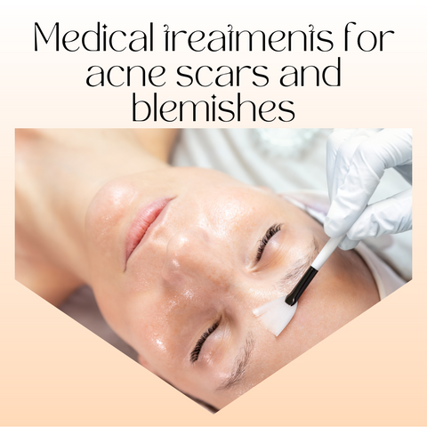 Medical treatments for acne scars and blemishes