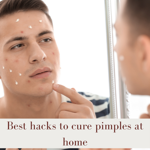 Best hacks to cure pimples at home