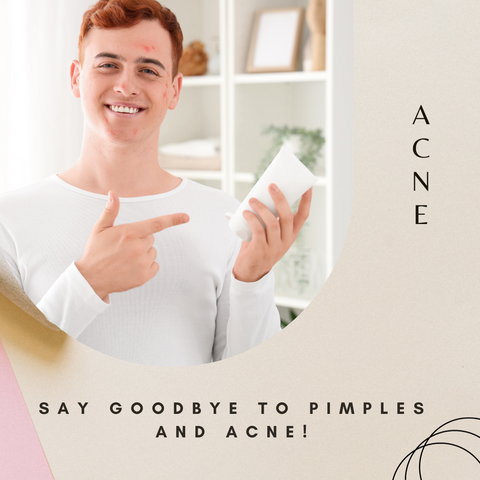 Say goodbye to pimples and acne!