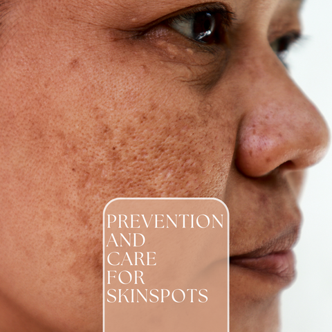 Prevention and Care for Skin Spots
