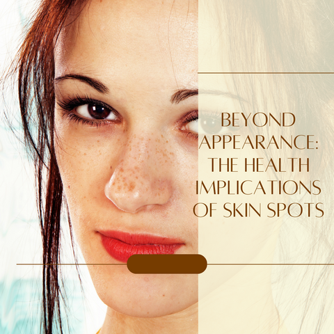 Beyond Appearance: The Health Implications of Skin Spots