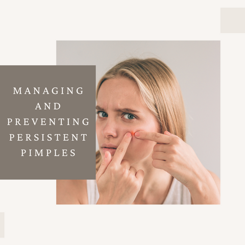 Managing and Preventing Persistent Pimples